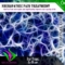 Neuropathic Pain Treatment