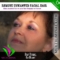 Remove Unwanted Facial Hair