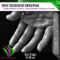 Stop Excessive Sweating