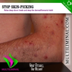 Stop Skin-picking